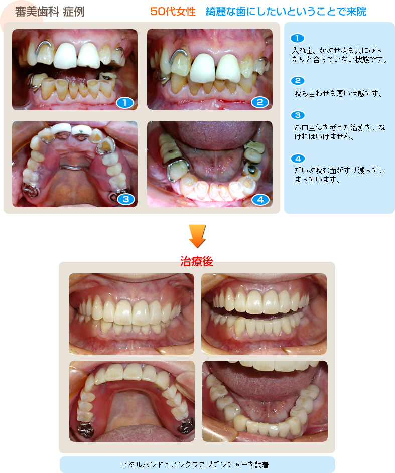 症例1